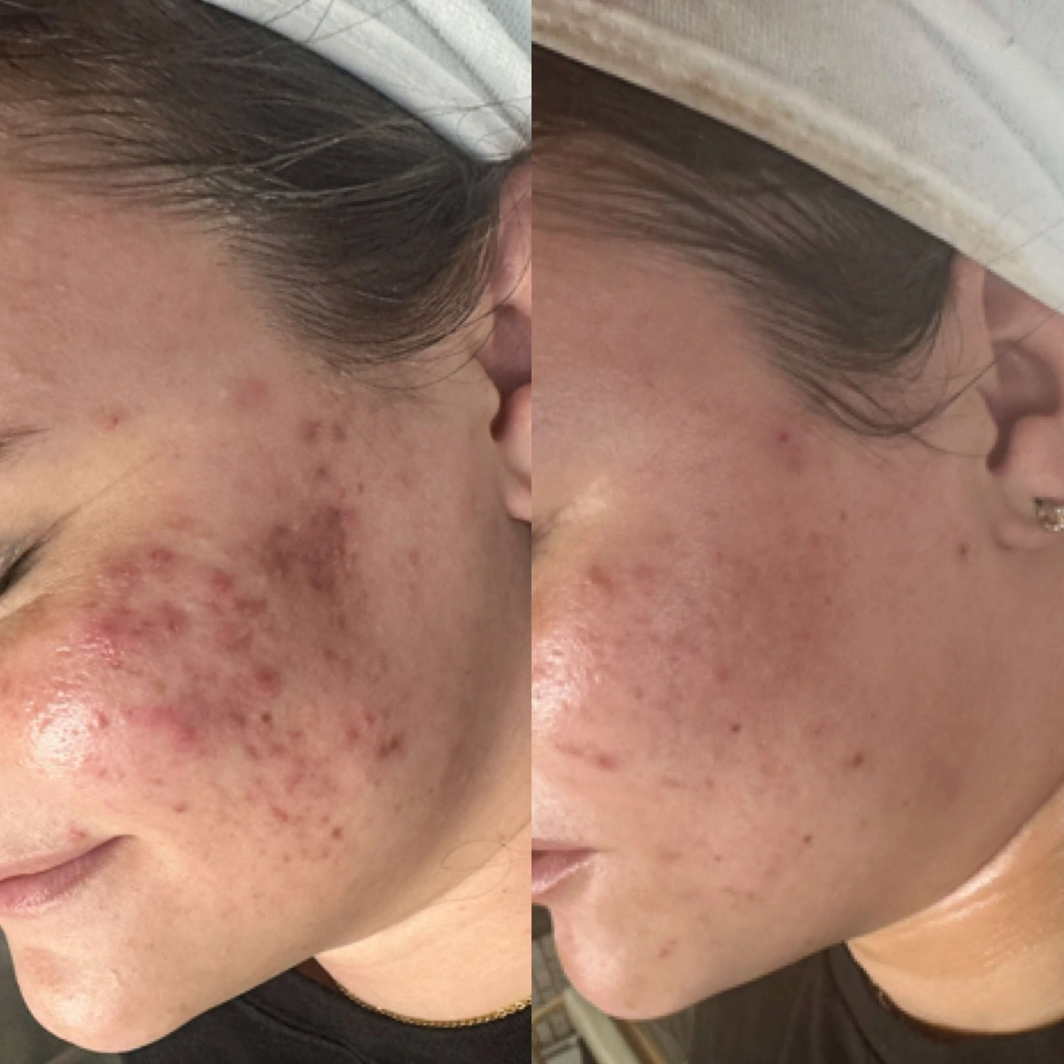 before and after