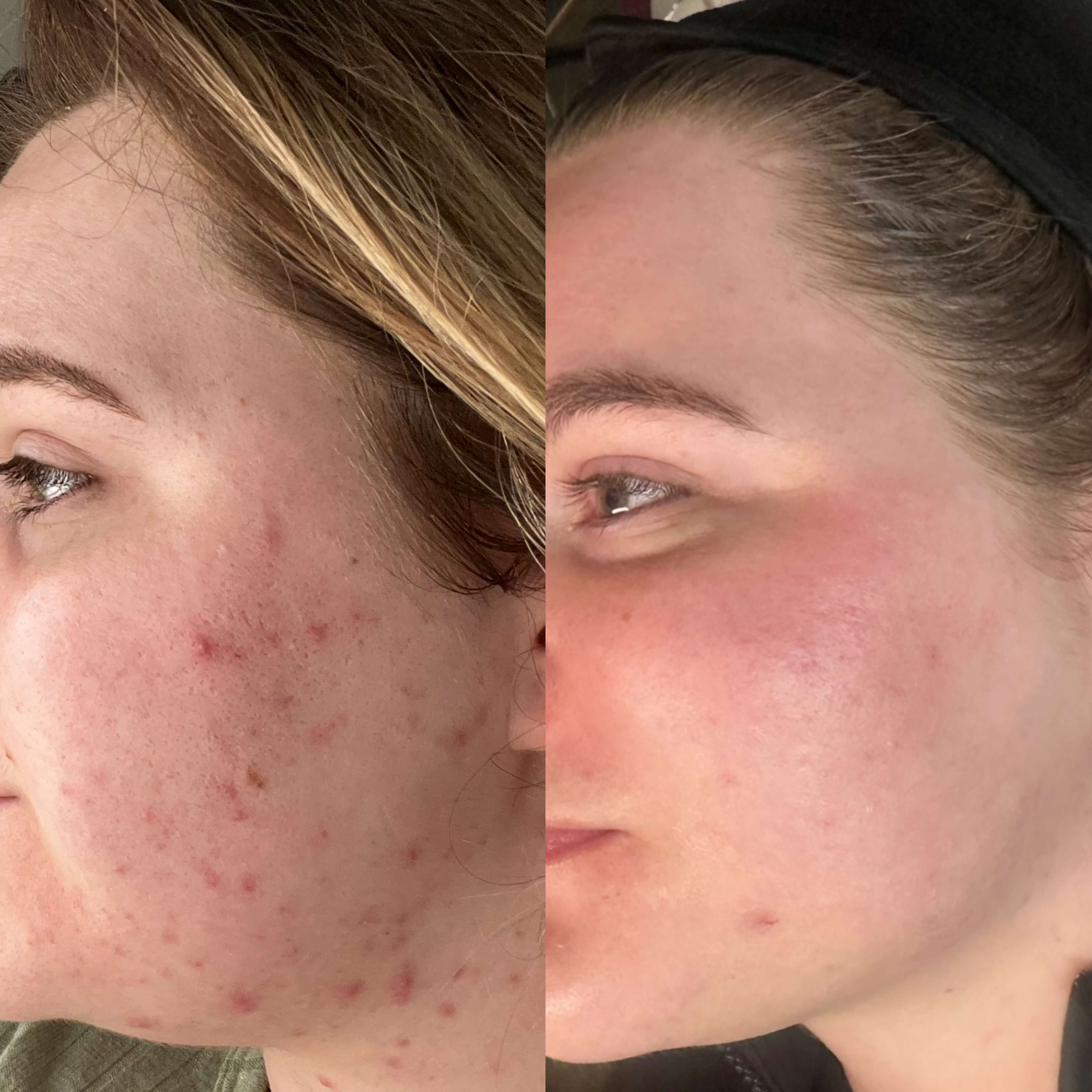 before and after