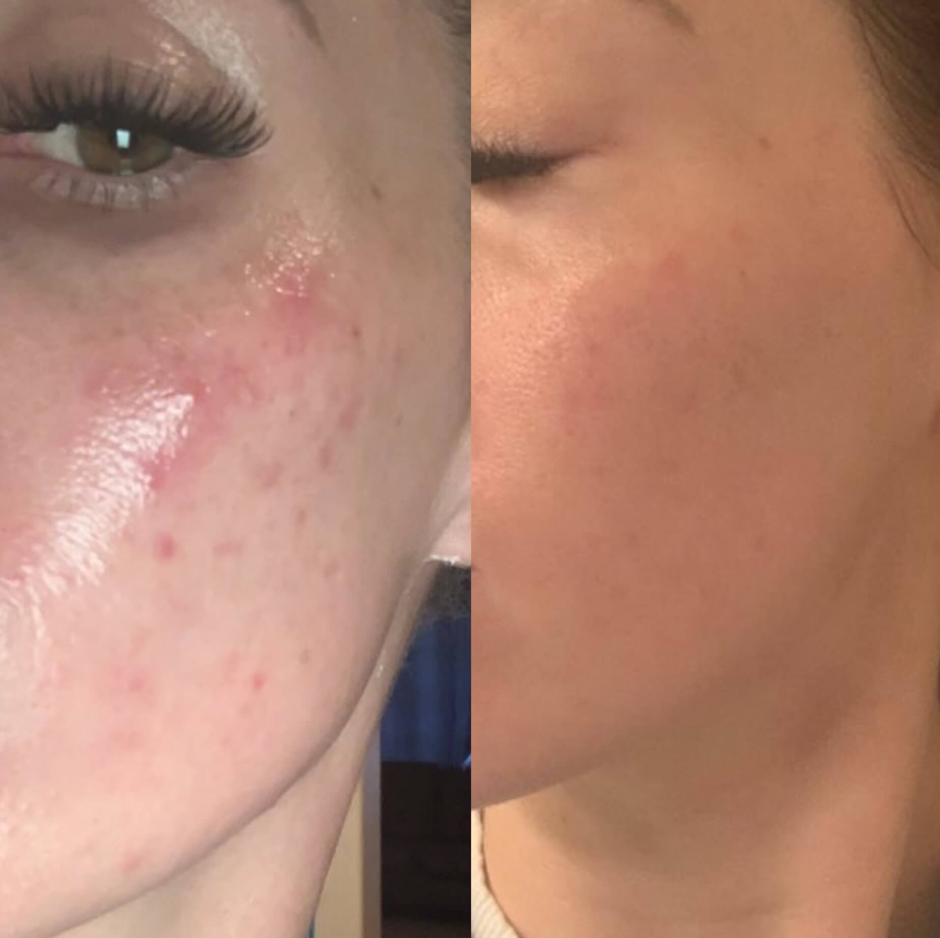 before and after