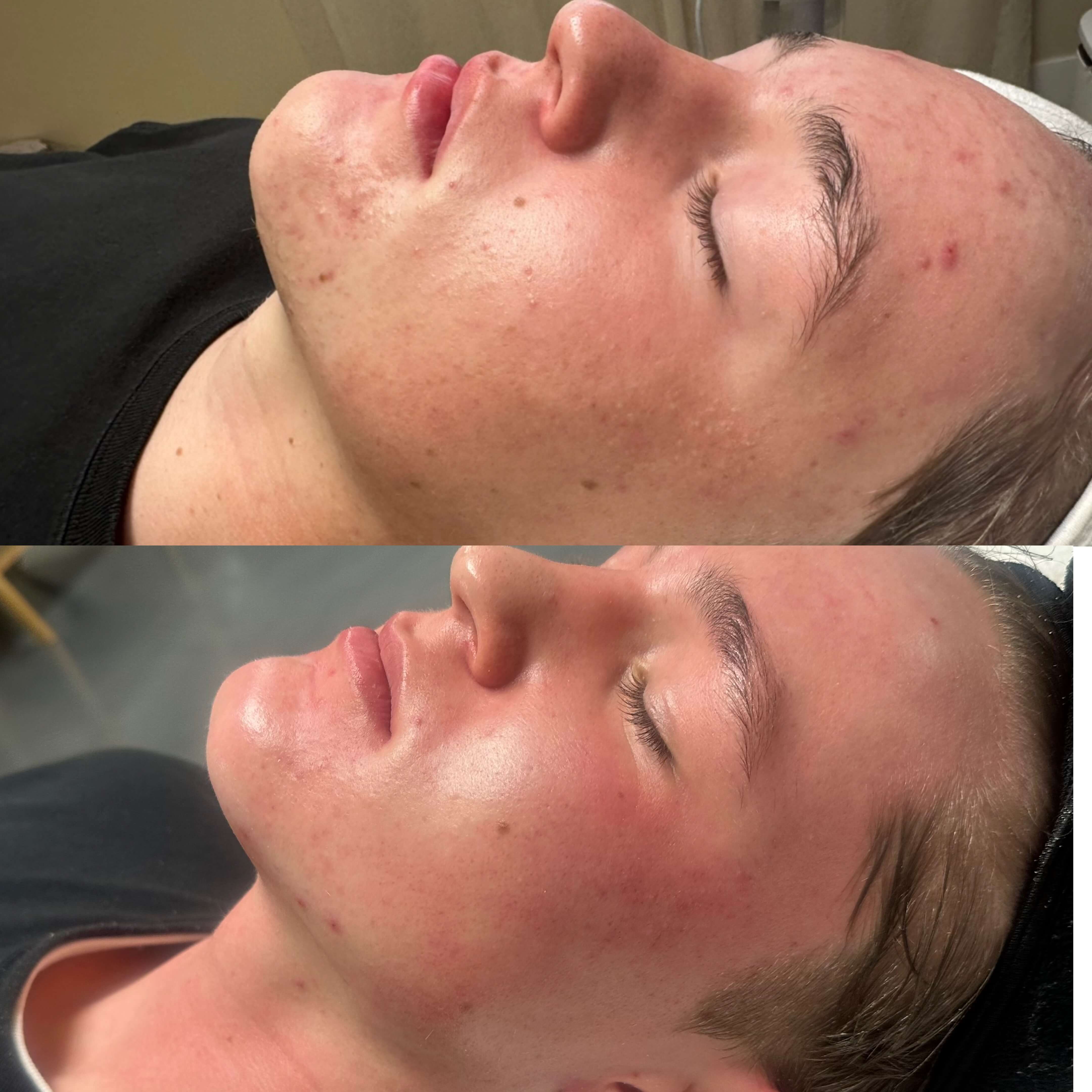 before and after