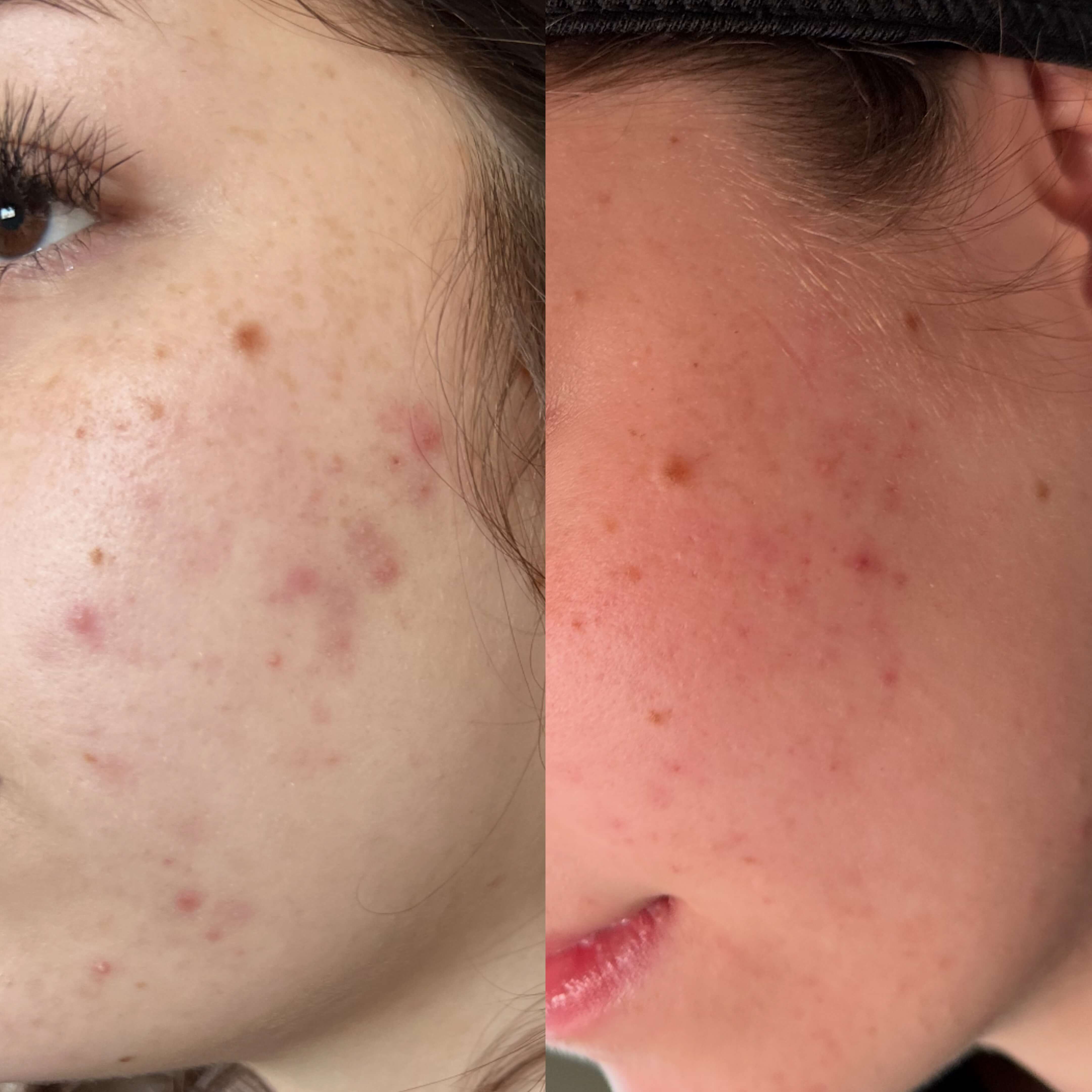 before and after